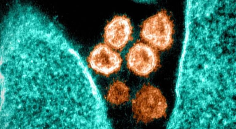 Método que impede totalmente a infecção pelo coronavírus é descoberto