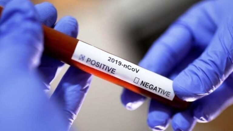 Estado de SE registra mais 137 novos casos de covid-19