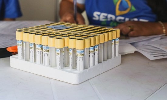 Câncer de próstata: Lacen já realizou 2.517 testes para detecção